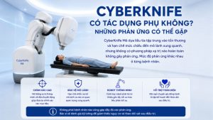 CyberKnife có tác dụng phụ không