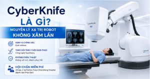 CyberKnife là gì