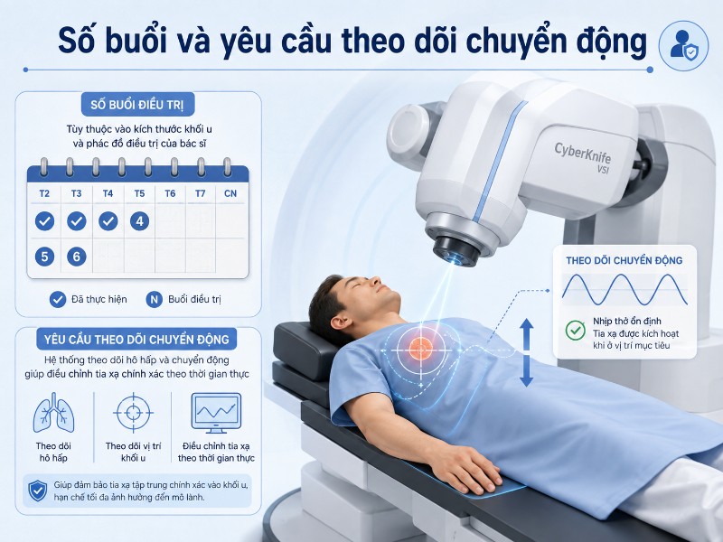 Chi phí điều trị CyberKnife