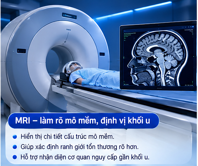 Chụp CT MRI PET CT trước CyberKnife