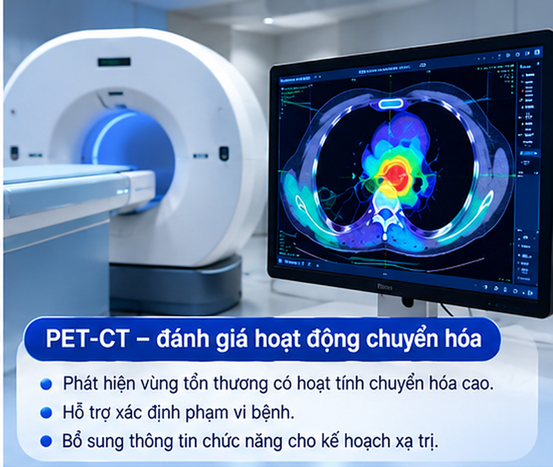 Chụp CT MRI PET CT trước CyberKnife