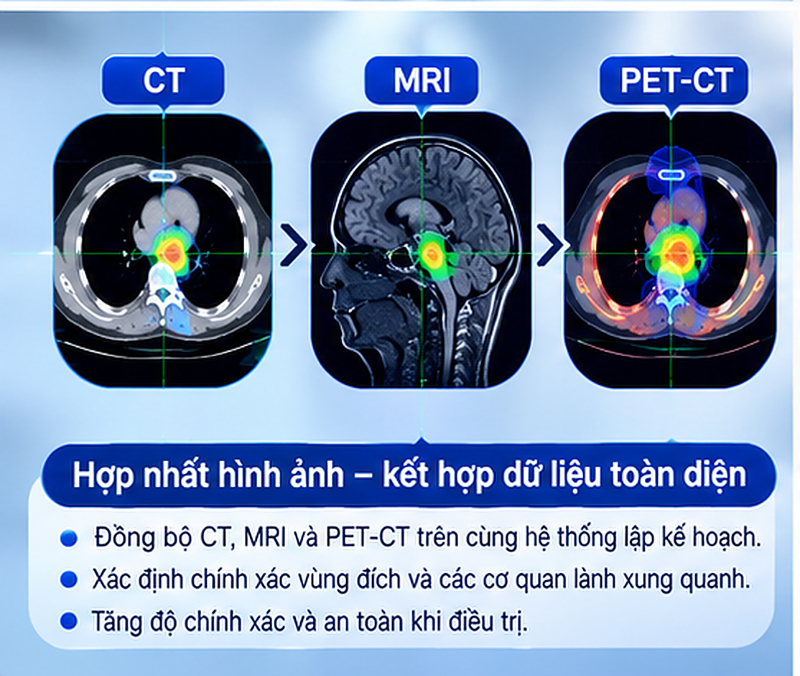 Chụp CT MRI PET CT trước CyberKnife