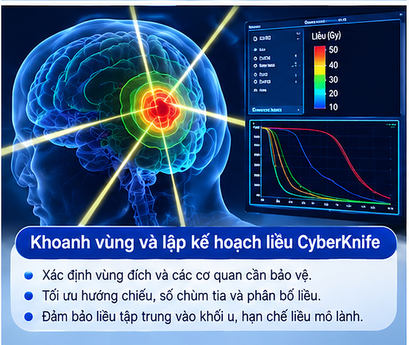 Chụp CT MRI PET CT trước CyberKnife