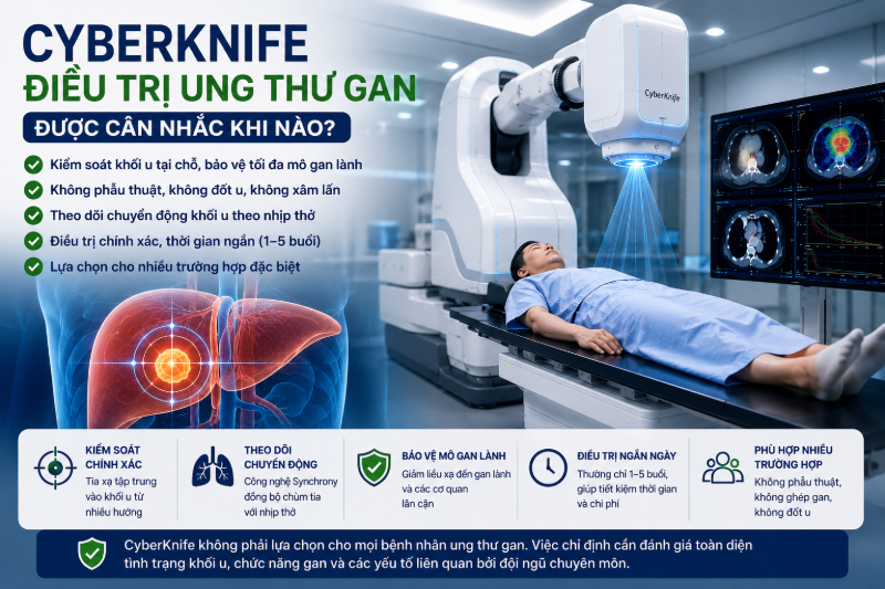 CyberKnife điều trị ung thư gan