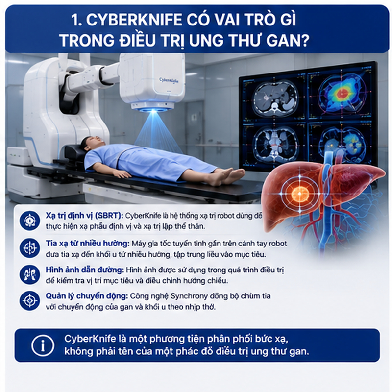 CyberKnife là hệ thống xạ trị robot dùng để thực hiện xạ phẫu định vị và xạ trị lập thể thân, thường được gọi là SBRT