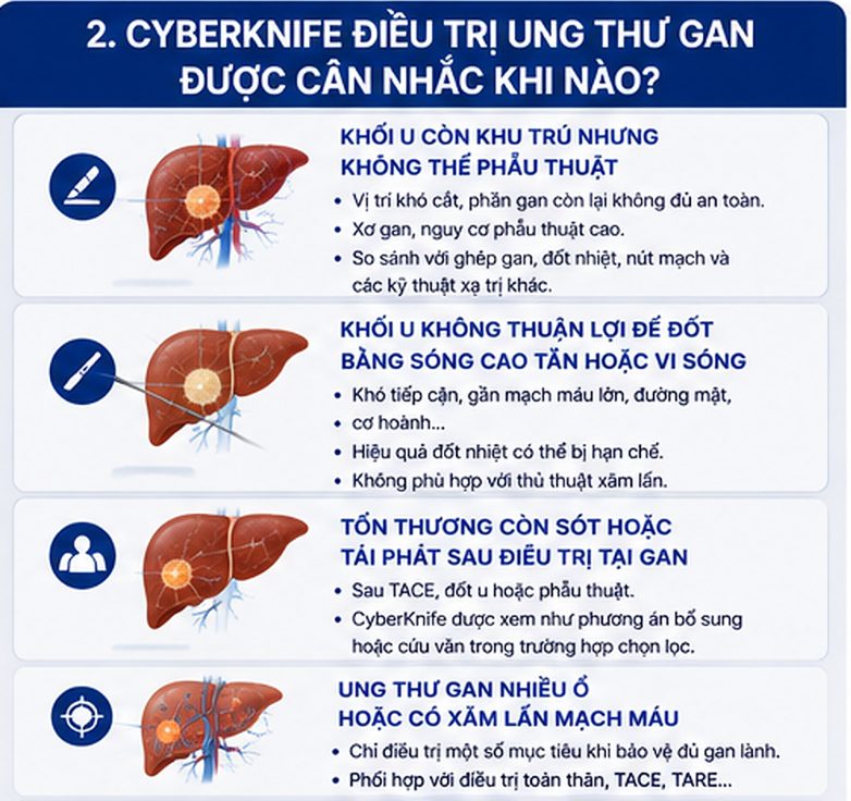 CyberKnife thường được đặt trong chiến lược điều trị đa mô thức