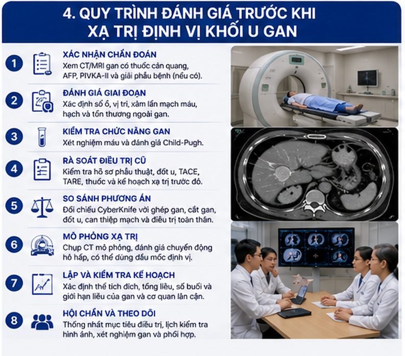 CyberKnife điều trị ung thư gan