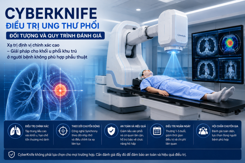CyberKnife điều trị ung thư phổi