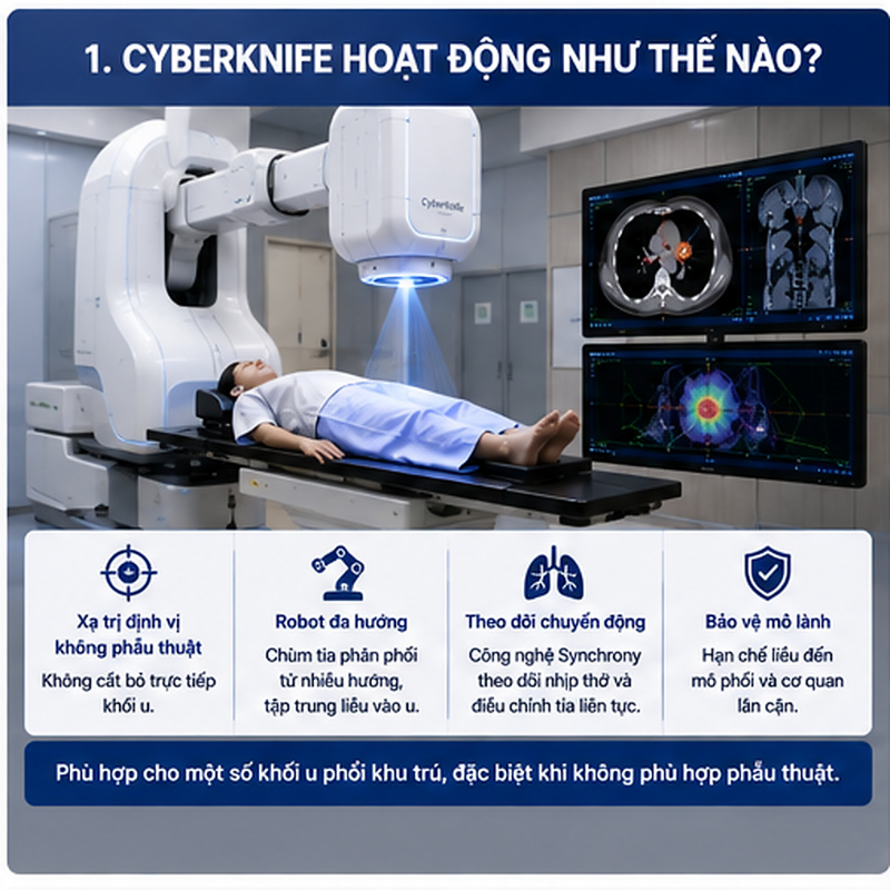 CyberKnife là hệ thống xạ trị robot dùng để thực hiện xạ phẫu định vị và xạ trị lập thể thân