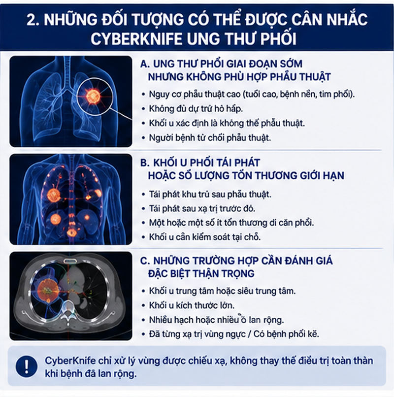 Những đối tượng có thể được cân nhắc xạ trị CyberKnife ung thư phổi