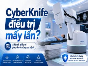 CyberKnife điều trị mấy lần