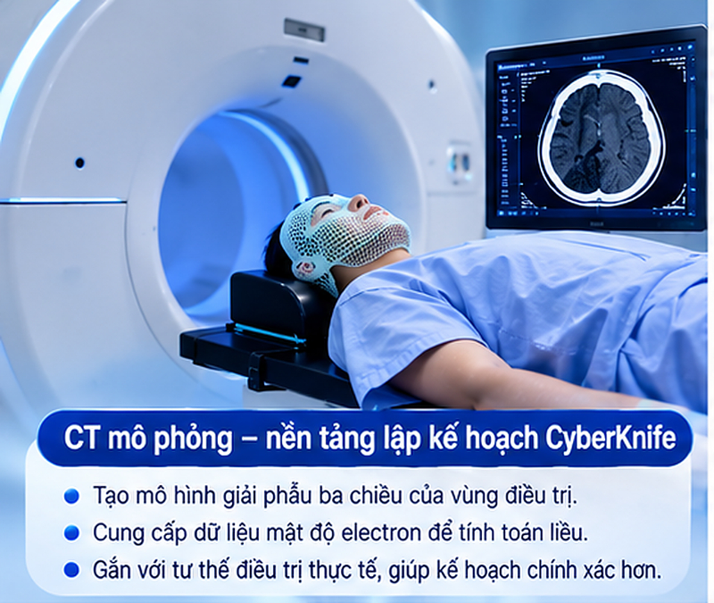 Chụp CT MRI PET CT trước CyberKnife