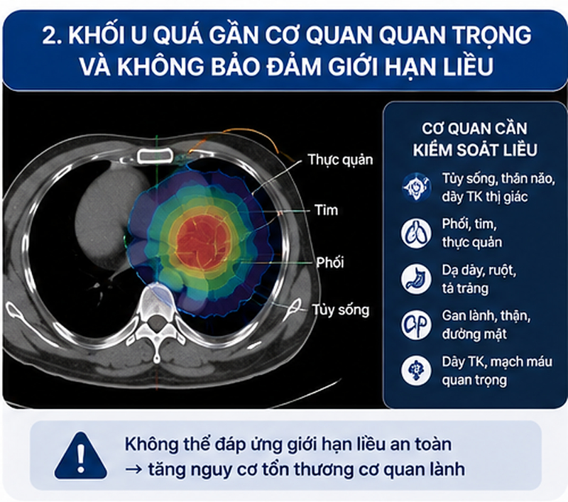Ai không phù hợp với CyberKnife