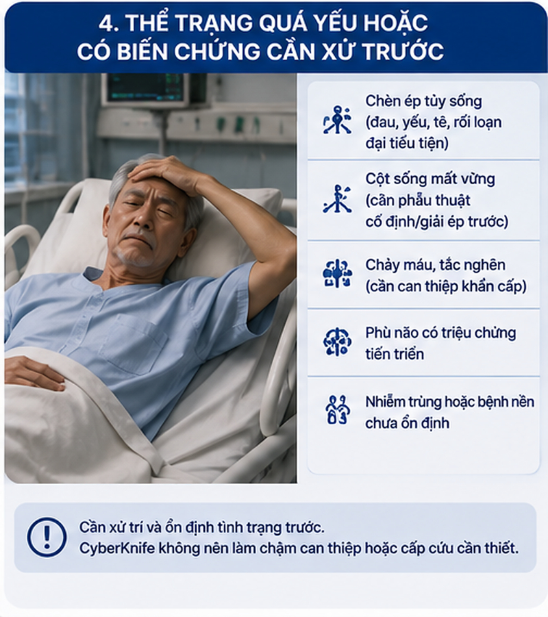 Ai không phù hợp với CyberKnife