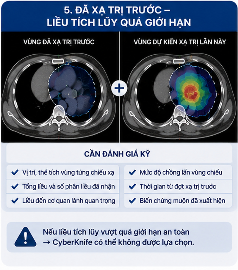 Ai không phù hợp với CyberKnife