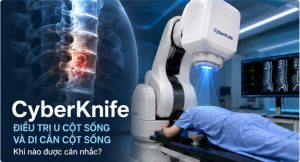 CyberKnife điều trị u cột sống