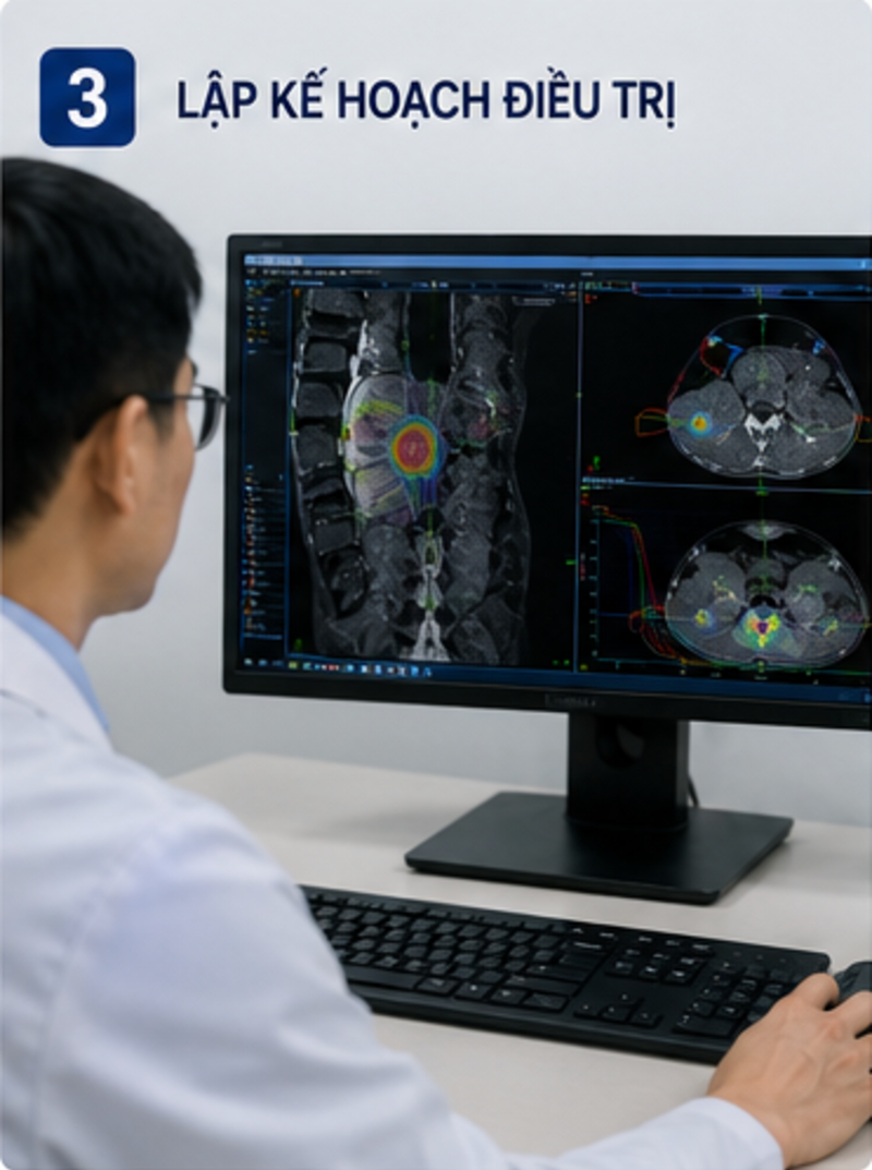 CyberKnife điều trị u cột sống
