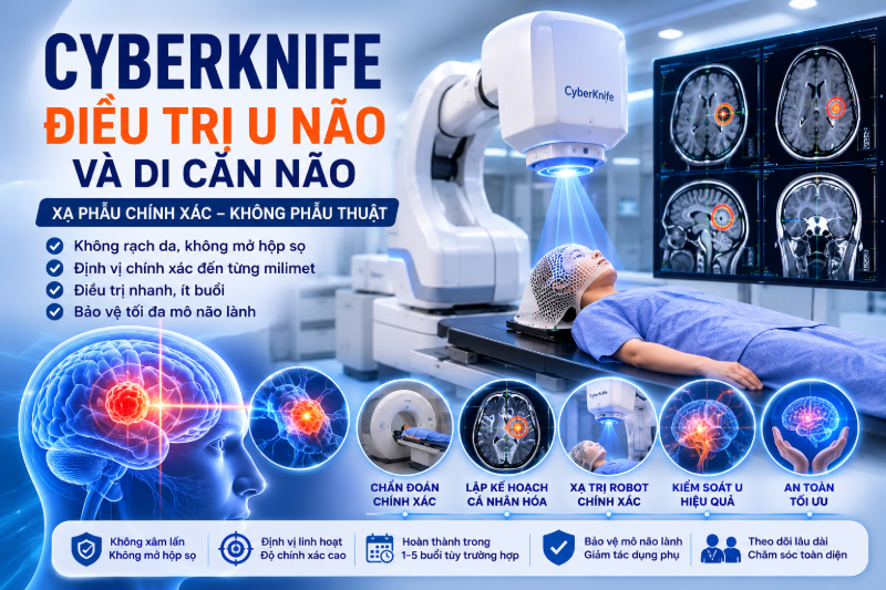 CyberKnife điều trị u não