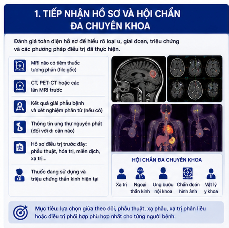 CyberKnife điều trị u não