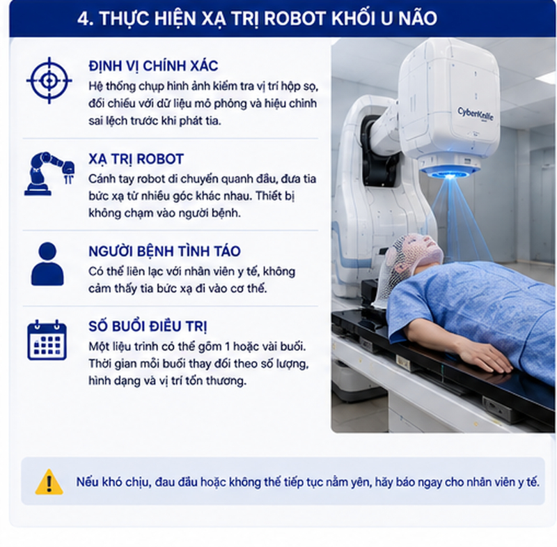 CyberKnife điều trị u não