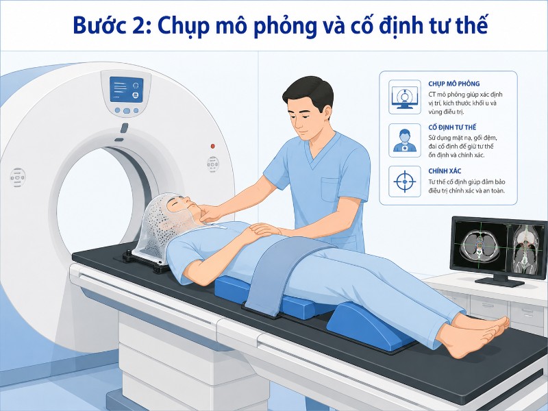 Quy trình điều trị CyberKnife