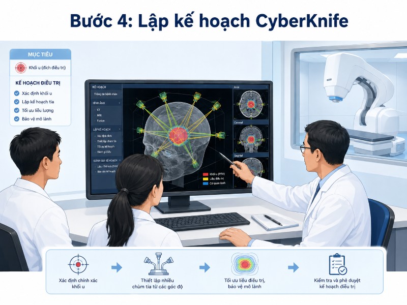 Quy trình điều trị CyberKnife