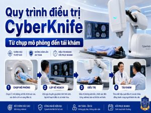 Quy trình điều trị CyberKnife