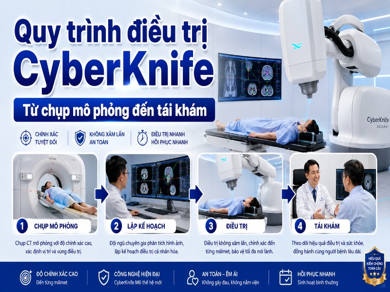 Quy trình điều trị CyberKnife