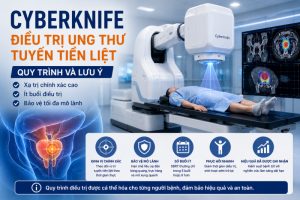 CyberKnife điều trị ung thư tuyến tiền liệt