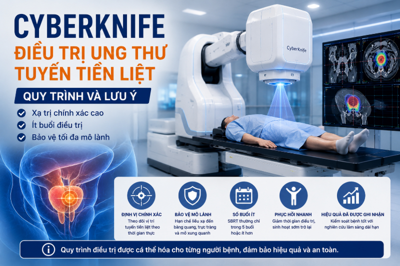 CyberKnife điều trị ung thư tuyến tiền liệt