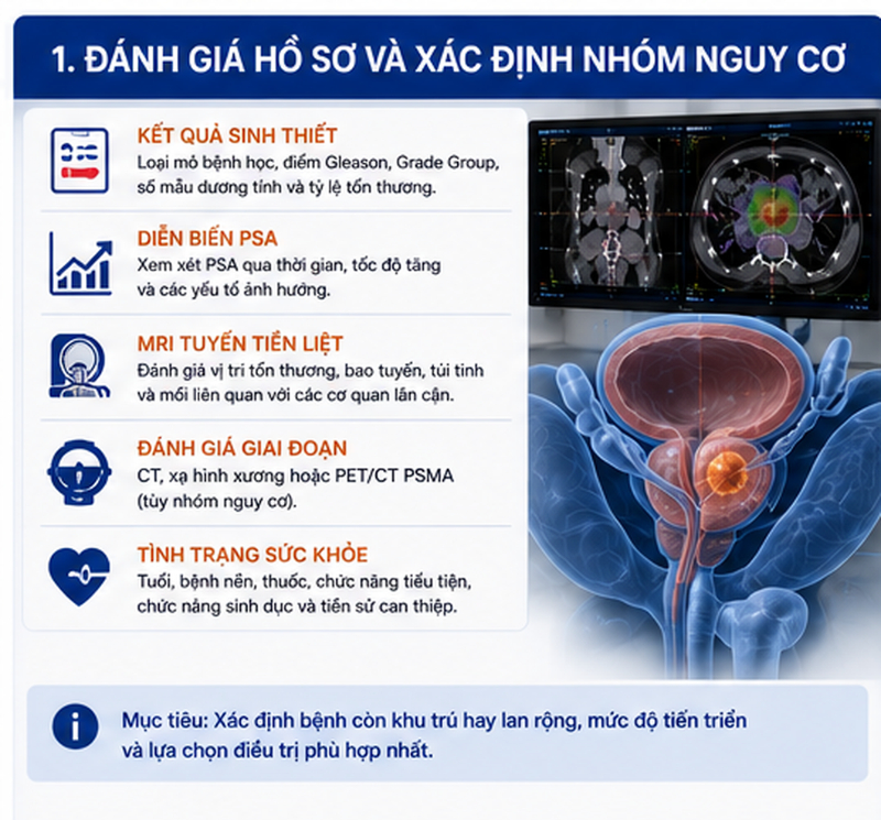 CyberKnife điều trị ung thư tuyến tiền liệt