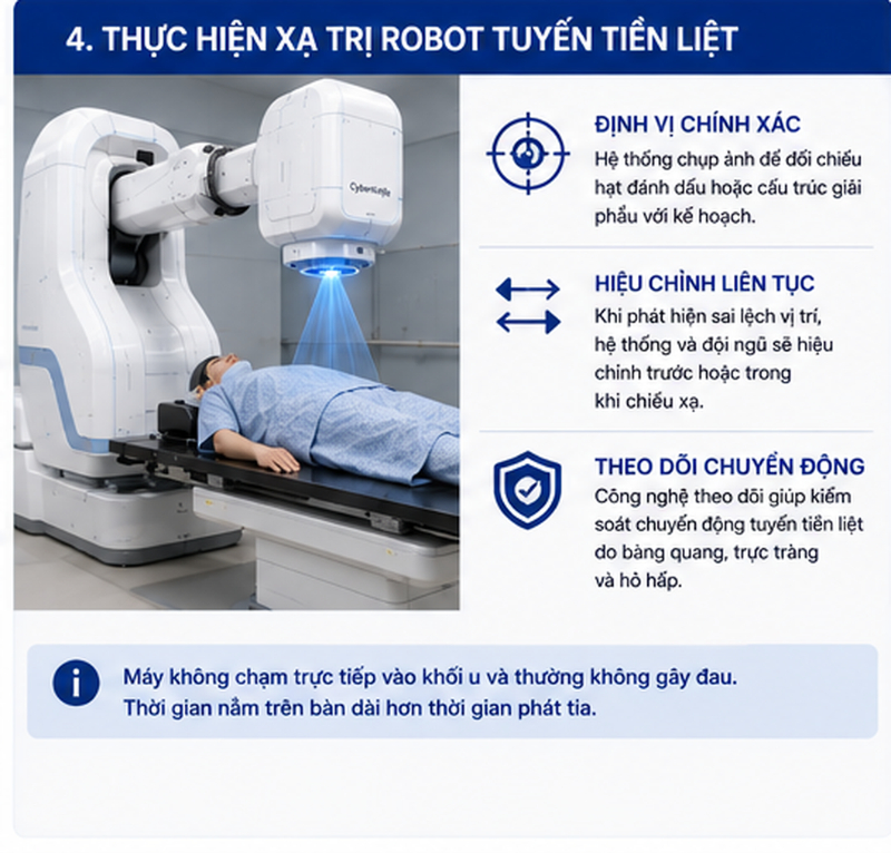 CyberKnife điều trị ung thư tuyến tiền liệt
