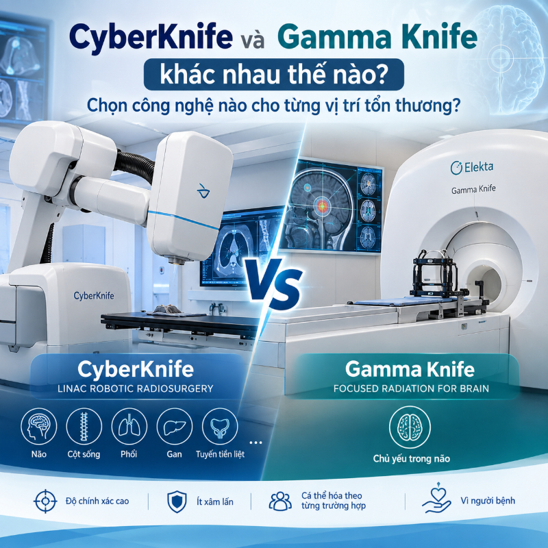 CyberKnife và Gamma Knife