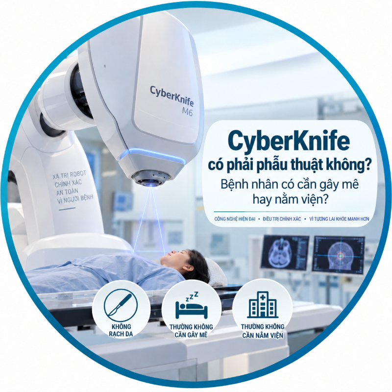 CyberKnife có phải phẫu thuật không